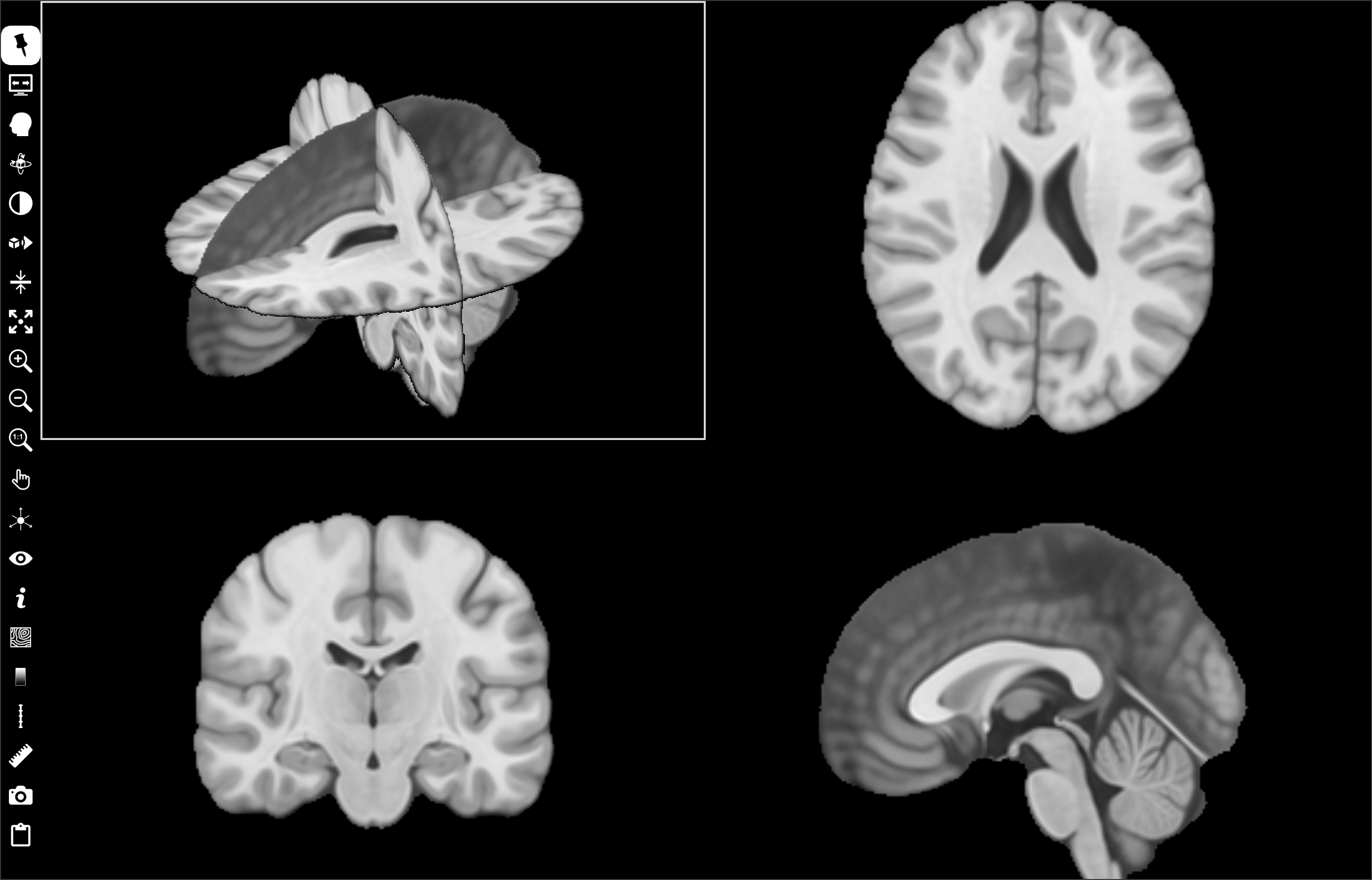 _images/ortho-view.png